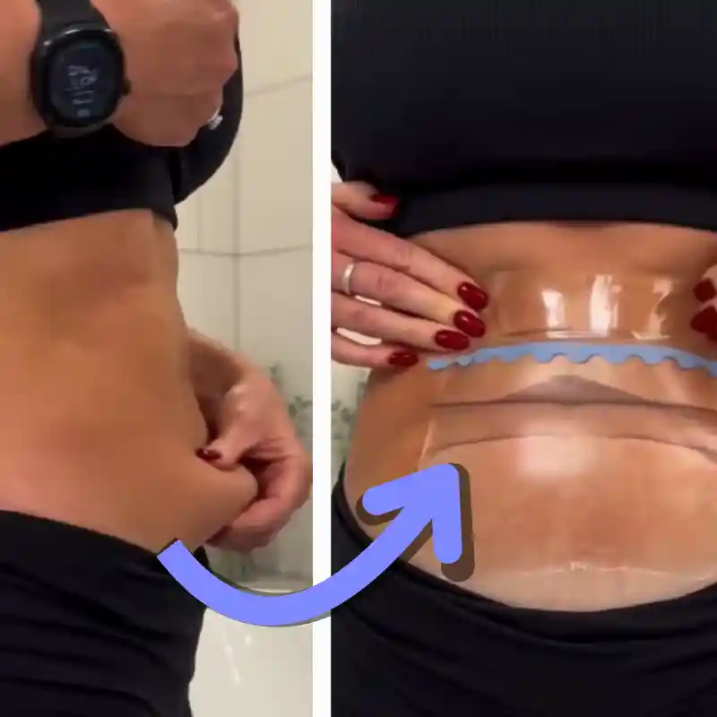 Before and after applying Shape Tapes lifting tape